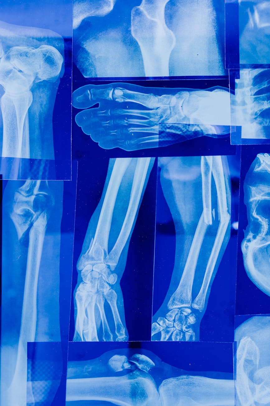 a various x ray imaging of a person s bones